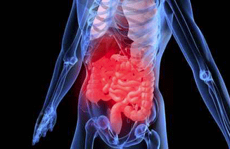 bowel_cancer_screening