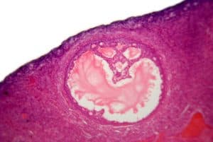 Ovarian cells image