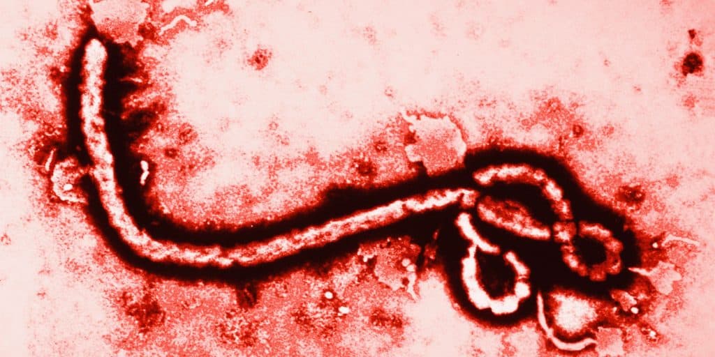 Colorised transmission electron micrograph of Ebola virus virion