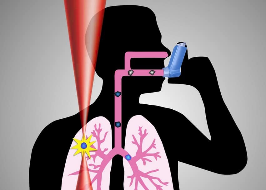 Asthma image