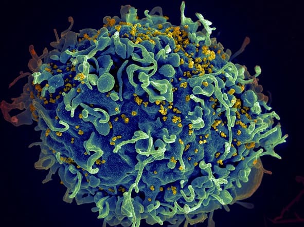 HIV infected cell