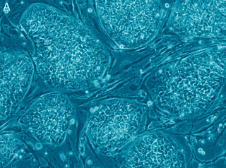 320px-human_embryonic_stem_cells_only_a