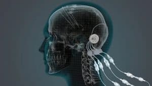 parkinsons_device_passion_productions